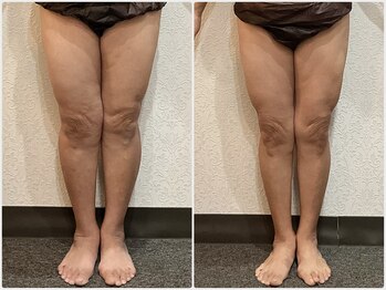 美容整体ウェリナ あま甚目寺院/小顔矯正/骨盤矯正/美脚サロン