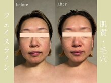 健志接骨院/πテラピー造顔メソッド
