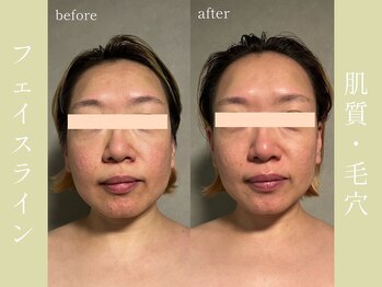 健志接骨院/πテラピー造顔メソッド