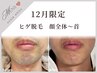【12月限定】初回メンズひげ脱毛(顔全体～首まで)★通常5,500円→