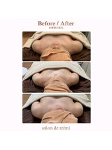 サロン ド ミミ(salon de mimi)/バストアップBeforeAfter