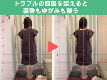鍼灸 整体院 ひわたし/◇根本改善なら姿勢も整います