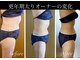 アリス 赤坂の写真/【鏡を見てふと気づく年齢による体型変化】/下腹の浮き輪や背中のハミ肉に上半身360度丸ごと痩身