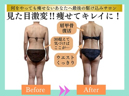 ヨサパーク ナンシー(YOSA PARK Nancy)の写真