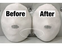 美極 トータルビューティー(美極 TOTAL BEAUTY)/恵比寿/小顔コルギ/エステ/