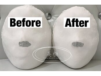 美極 トータルビューティー(美極 TOTAL BEAUTY)/恵比寿/小顔コルギ/エステ/