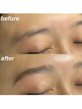 ソルーナ(SOLUNA)/ハリウッドブロウリフト