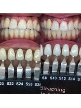 トウキョースワーズ 渋谷店(TOKYO SWRS)/#ホワイトニング #渋谷 #池袋