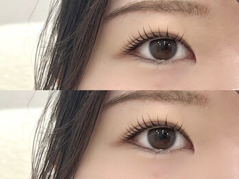 アルーマ アイ(allma.eye)/まつ毛パーマ/ラッシュリフト
