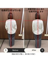ルピナス整体院/骨盤矯正後の写真