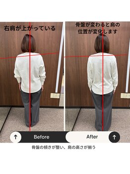 ルピナス整体院/骨盤矯正後の写真