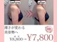 ニコ(NICO)の写真
