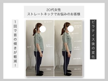 ウィット(Wit.)/ストレートネックが気になる方