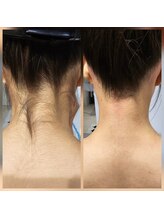 アールスサロン/うなじシュガーリング