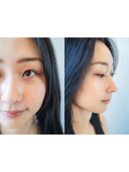 アイブロウメニューがあるサロン