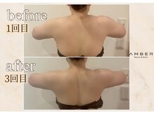 アンバー 恵比寿(AMBER)/デスクワークで辛い肩凝りに..