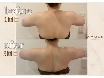 アンバー 恵比寿(AMBER)/デスクワークで辛い肩凝りに..