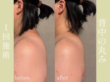 健志接骨院/姿勢も変わる！？