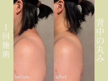 健志接骨院/姿勢も変わる！？