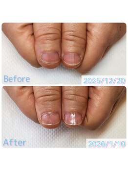 スペシャルハンドケア