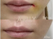 アリリィ(ARILY)/ARILY after care salon