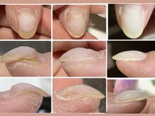 テンダーセント(Tender Scent)/爪育成