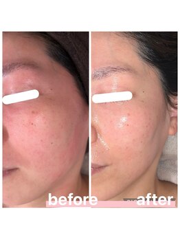 プリマ 大津店(PRIMA)/発光肌オーダーメイドエステ☆