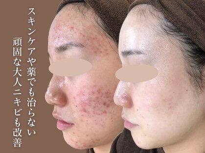 エピア 豊田店(Epia)の写真