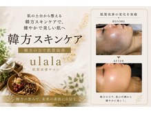 ウララ(ulala)