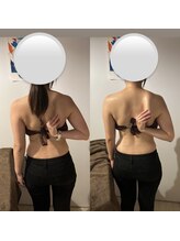 カシェット(cachette)/肩甲骨剥がし