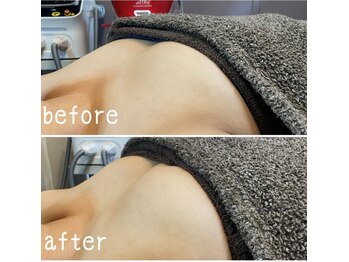 ガーデン(Garden)/バストケア2