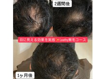 レアティ(Leathy)の雰囲気（目に見える効果を実感！サロンで気兼ねなく頭皮ケア予防が出来る）