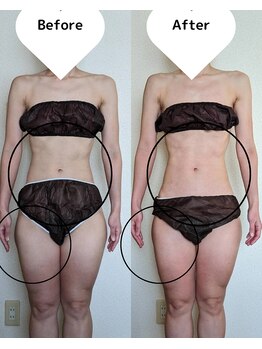 サロン ド ベルメール(Salon de Belle mer)/リンパマッサージ/痩身/リンパ