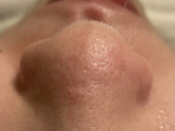 リセットプラス(Reset+)/