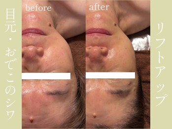 健志接骨院/πテラピー造顔メソッド