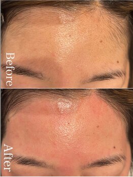 ジョエルワックス 沖縄那覇店(JOELLE WAX)/新規女性★フェイスワックス