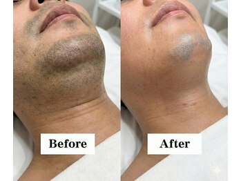 ワイイーサロン(Y/E SALON)