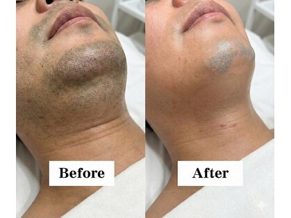 ワイイーサロン(Y/E SALON)の写真