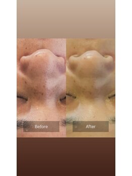 salon SUI 祐天寺【スウェディッシュマッサージ/美容整体/首肩こり頭痛】/