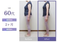 ビップ 赤坂店(Bipp!)/60代・2カ月の変化
