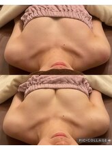 アネラ 京都駅前店(Anela)/【Before & After 】