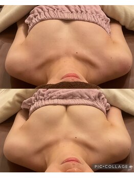 アネラ 京都駅前店(Anela)/【Before & After 】