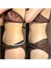 カシェット(cachette)/ウルトラ痩身