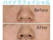 ライズ 岩見沢店(RISE)/【ハイドラ】ビフォーアフター