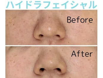ライズ 岩見沢店(RISE)/【ハイドラ】ビフォーアフター