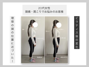 ウィット(Wit.)/巻き肩・猫背・お腹が気になる方