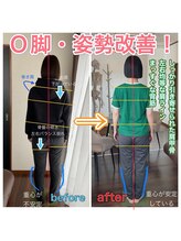整体院ヒカリノキュウジツ 鹿沼店/症例紹介◆O脚&姿勢にお悩み