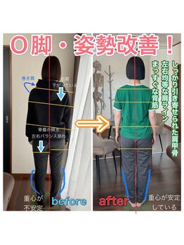 整体院ヒカリノキュウジツ 鹿沼店/症例紹介◆O脚&姿勢にお悩み