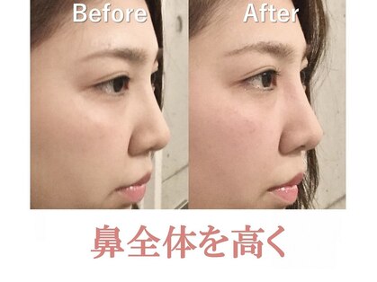 ラプリ 横浜店(Raplit)の写真