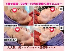 CBDサロン ローズ(ROSE)の雰囲気（20代～70代の方多数ご来店。スッキリ、ハリツヤのある肌へ。）